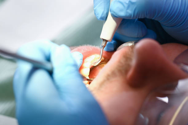 Best Mobile Emergency Dentist in Belvidere, IL